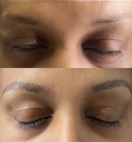 Powdered Brows Before After - Lip Doctor